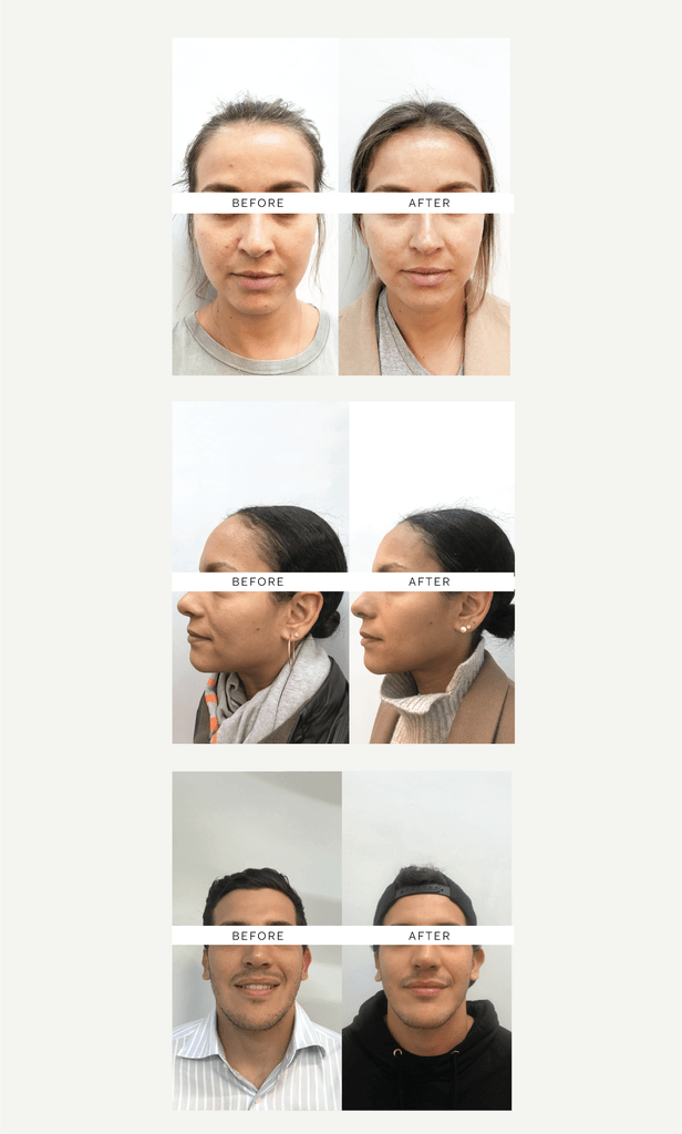 SKIN FILTER: The Results