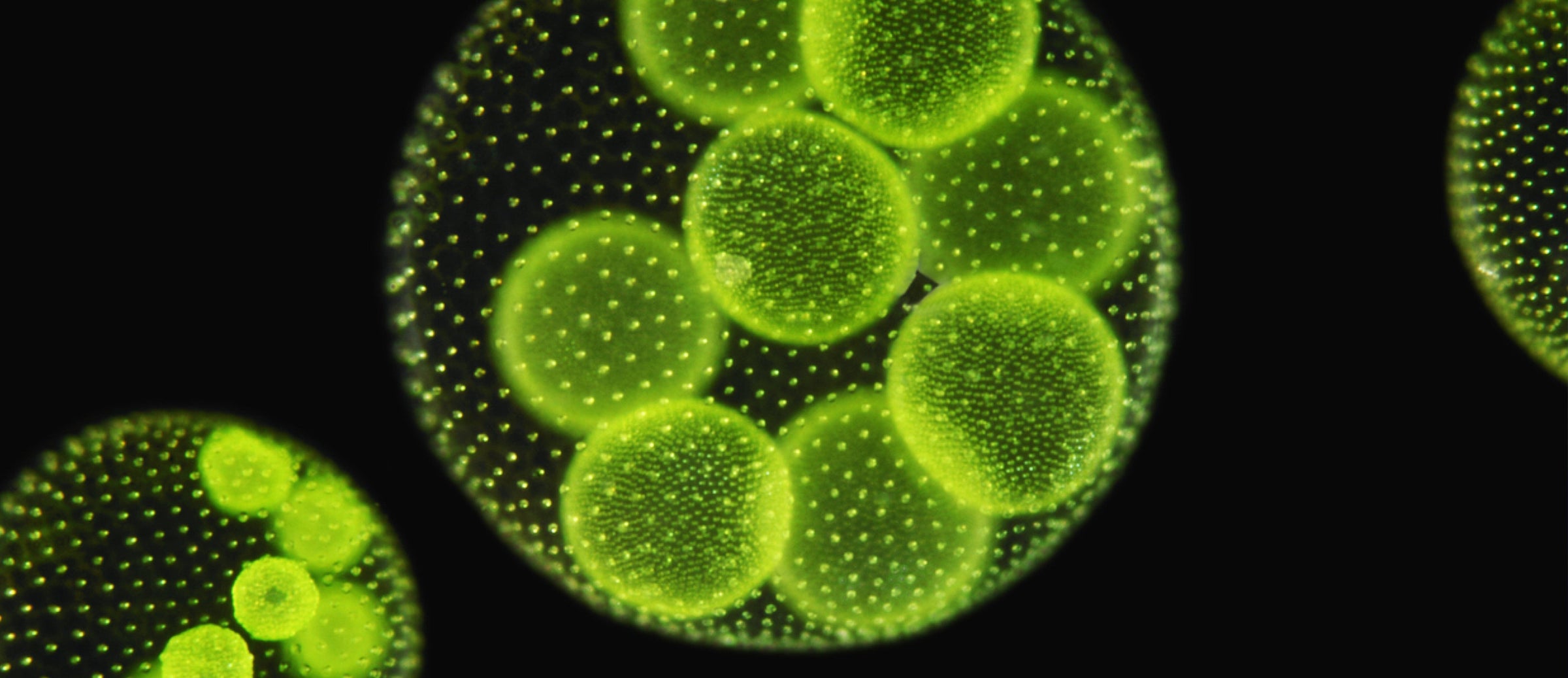 Is Bacteria the Secret to Finding True Love?