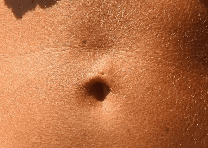 Can Coffee Cause Bloating?