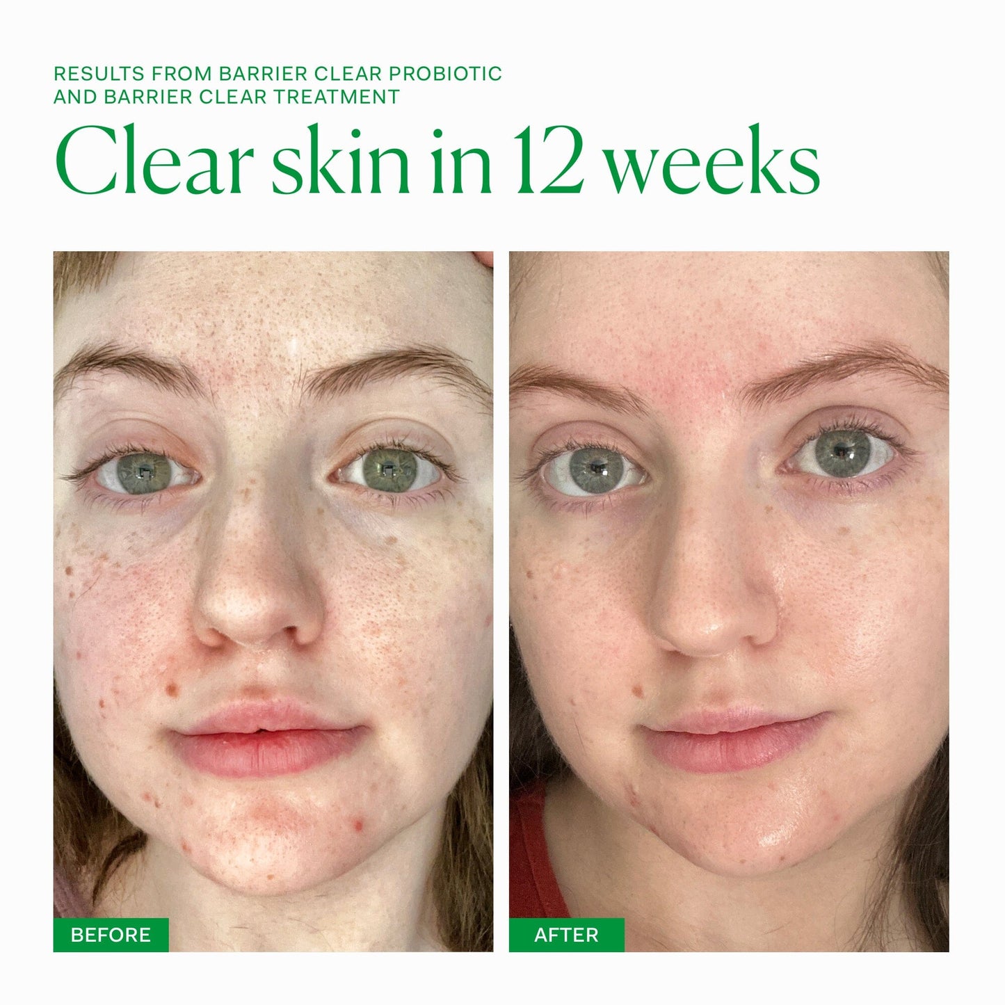 Barrier Clear Collection The Nue Co. UK