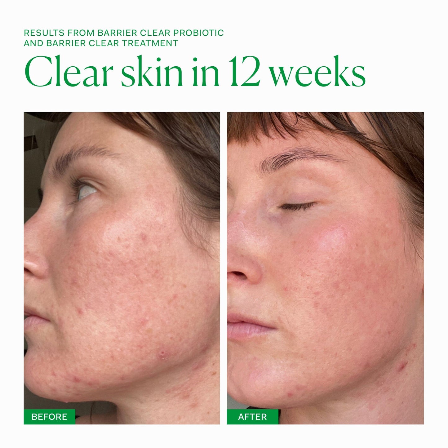 Barrier Clear Treatment single The Nue Co.