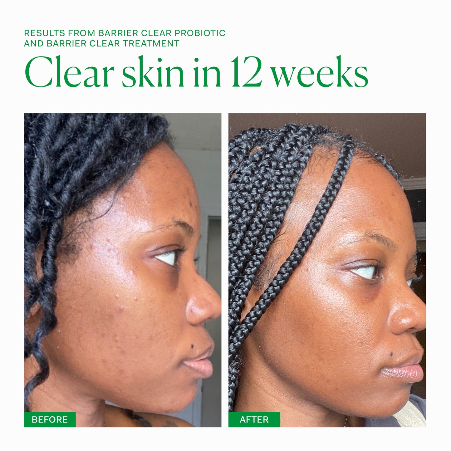 Barrier Clear Probiotic single The Nue Co.