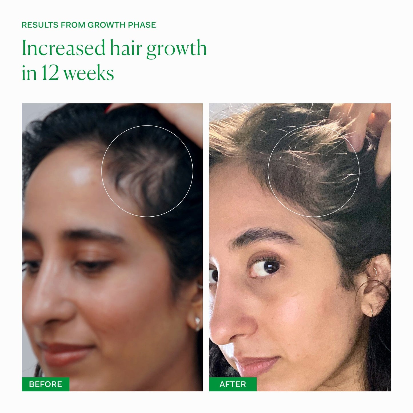 THE HAIR GROWTH COLLECTION The Nue Co. UK