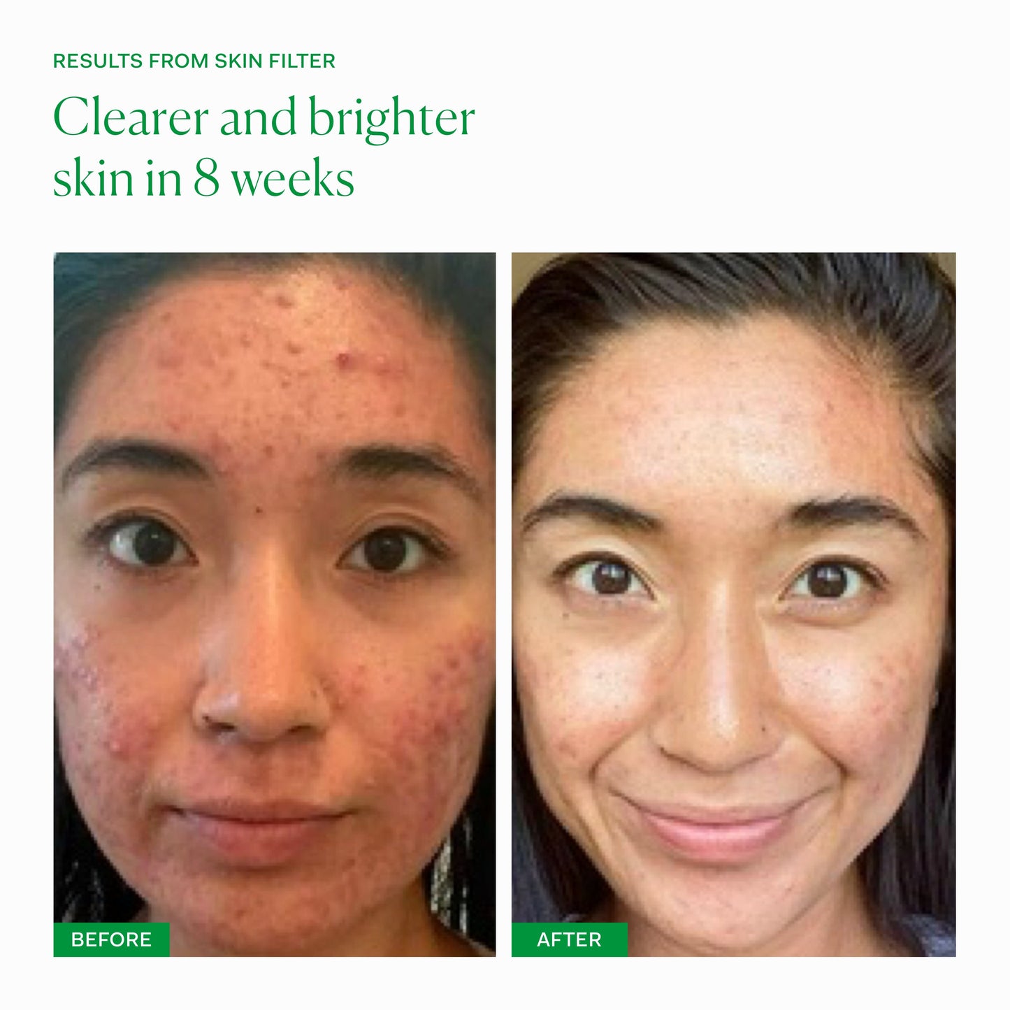 SKIN FILTER COLLECTION The Nue Co. UK
