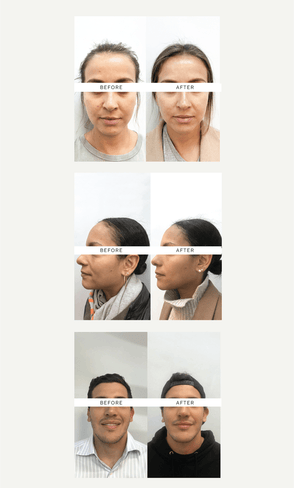 SKIN FILTER: The Results