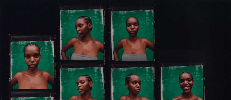 SKIN FILTER: The Results