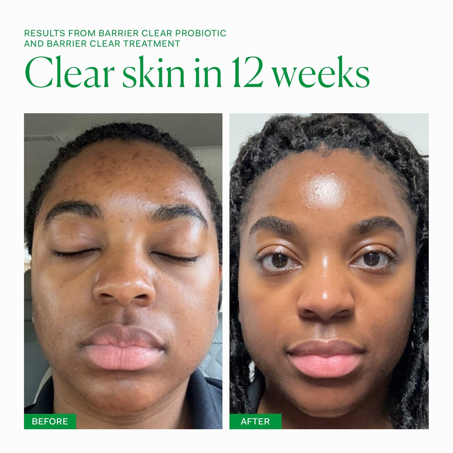 Barrier Clear Collection The Nue Co. UK 