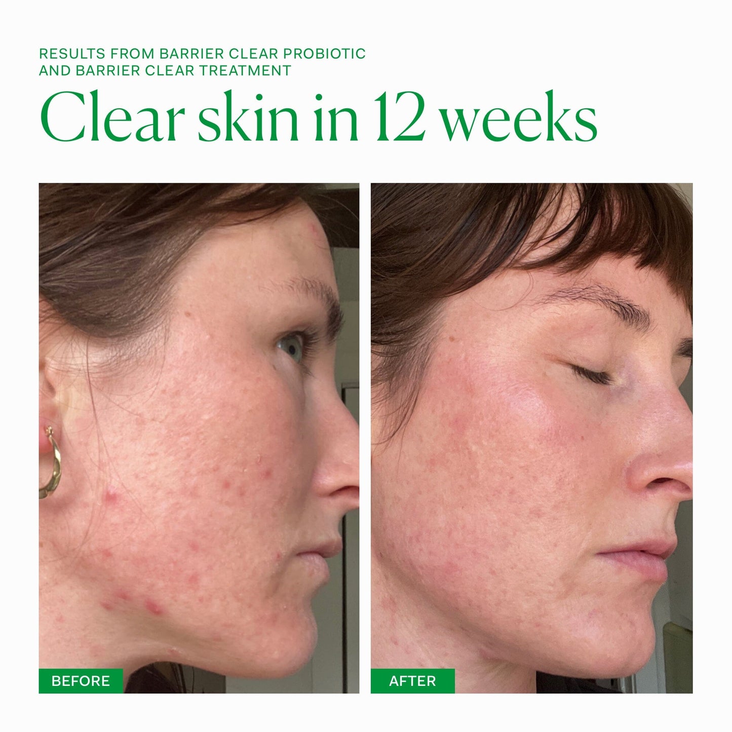 Barrier Clear Collection The Nue Co. UK 