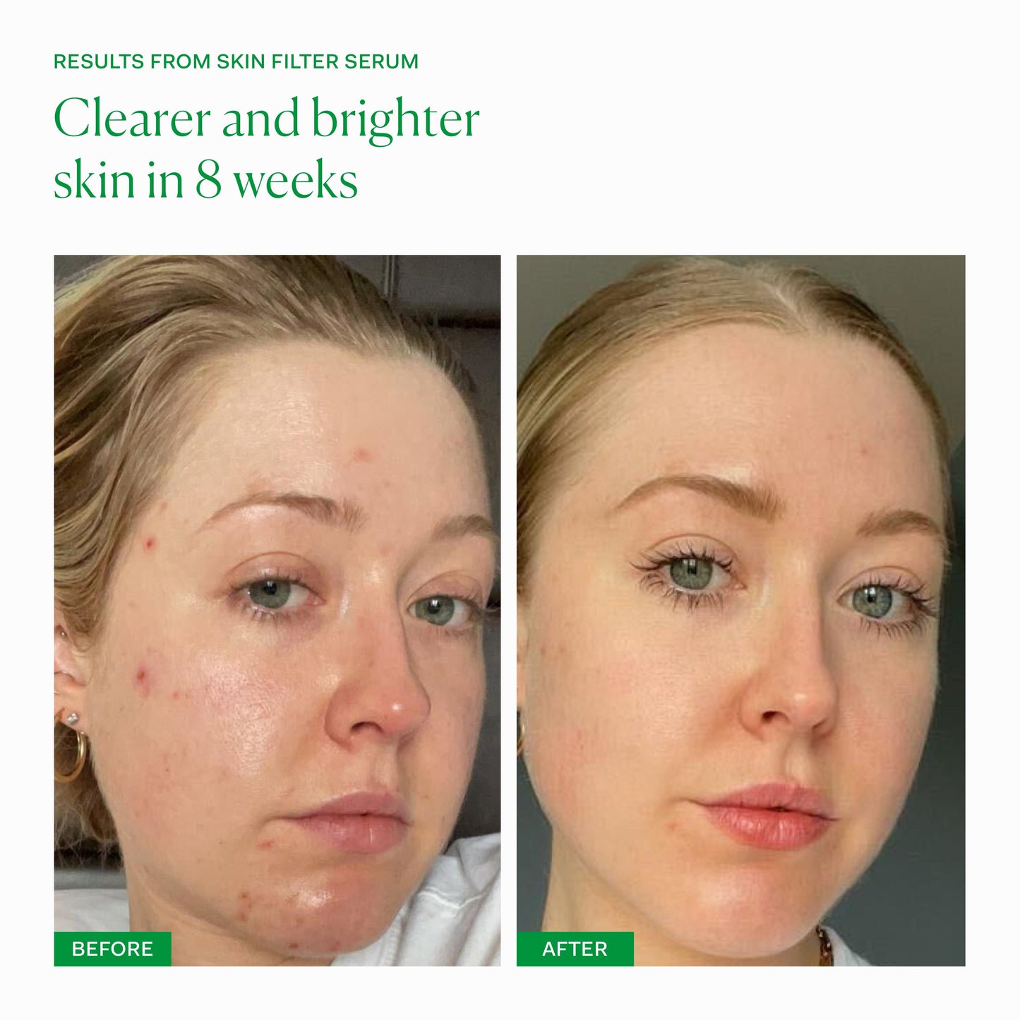 SKIN FILTER single The Nue Co. 